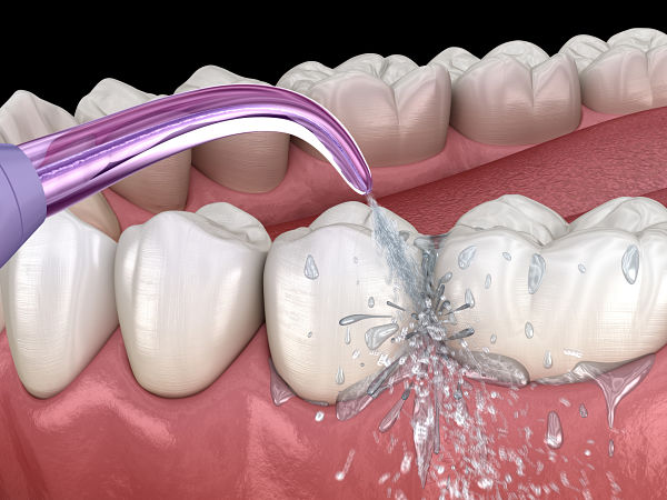 IRRIGADOR BUCAL PORTATIL