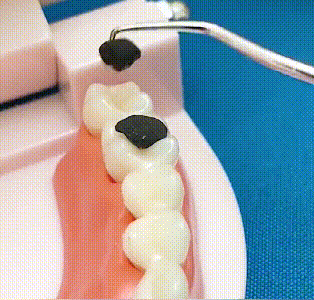 KIT DE LIMPIEZA DENTAL PROFUNDA